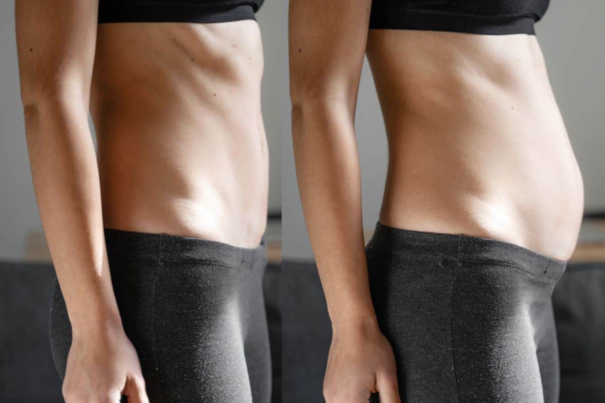 How long does diastasis recti take to improve Isle of Dogs?