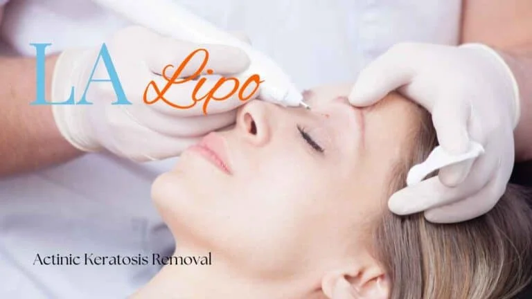 Woman receiving Actinic Keratosis Removal Treatment Isle of Dogs
