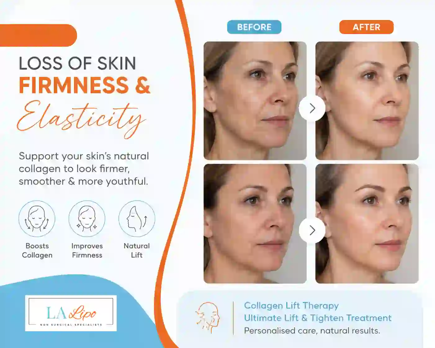 Sign #7: Loss of Skin Firmness and Elasticity Isle of Dogs